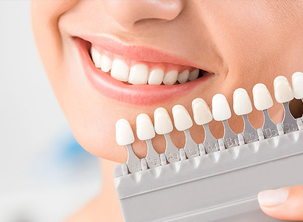 Benefits Of Porcelain Veneers In Adelaide: A Complete Guide